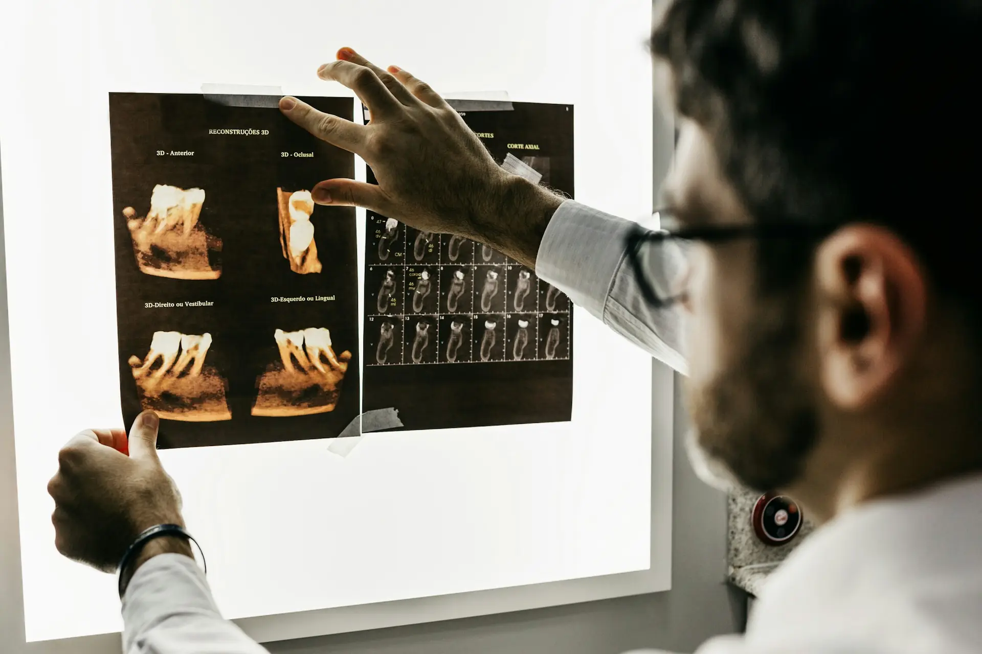 Specialista che esamina radiografie e modelli dentali digitali