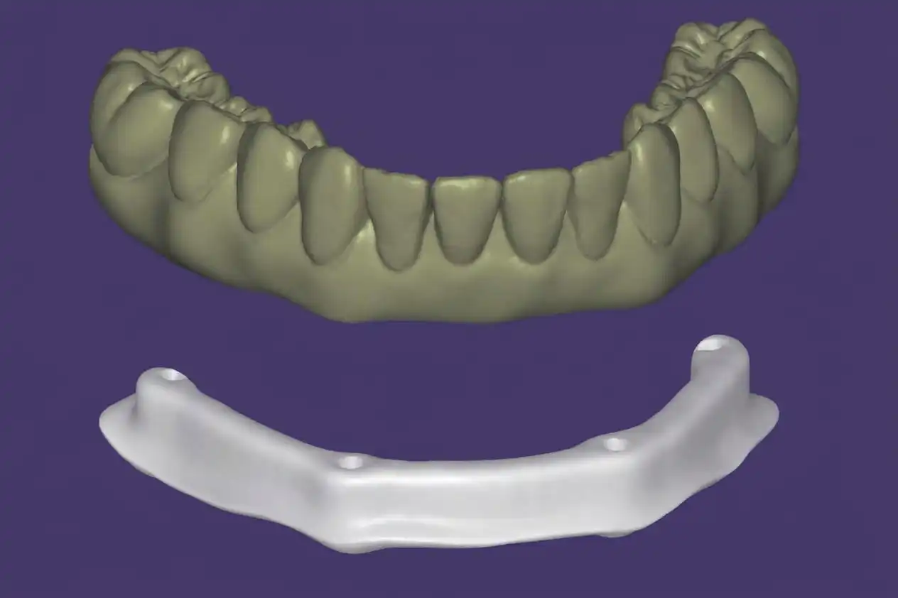 Progettazione CAD della split bar e della sovrastruttura