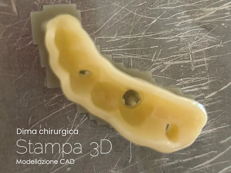 Dima chirurgica stampata in 3D da modellazione CAD